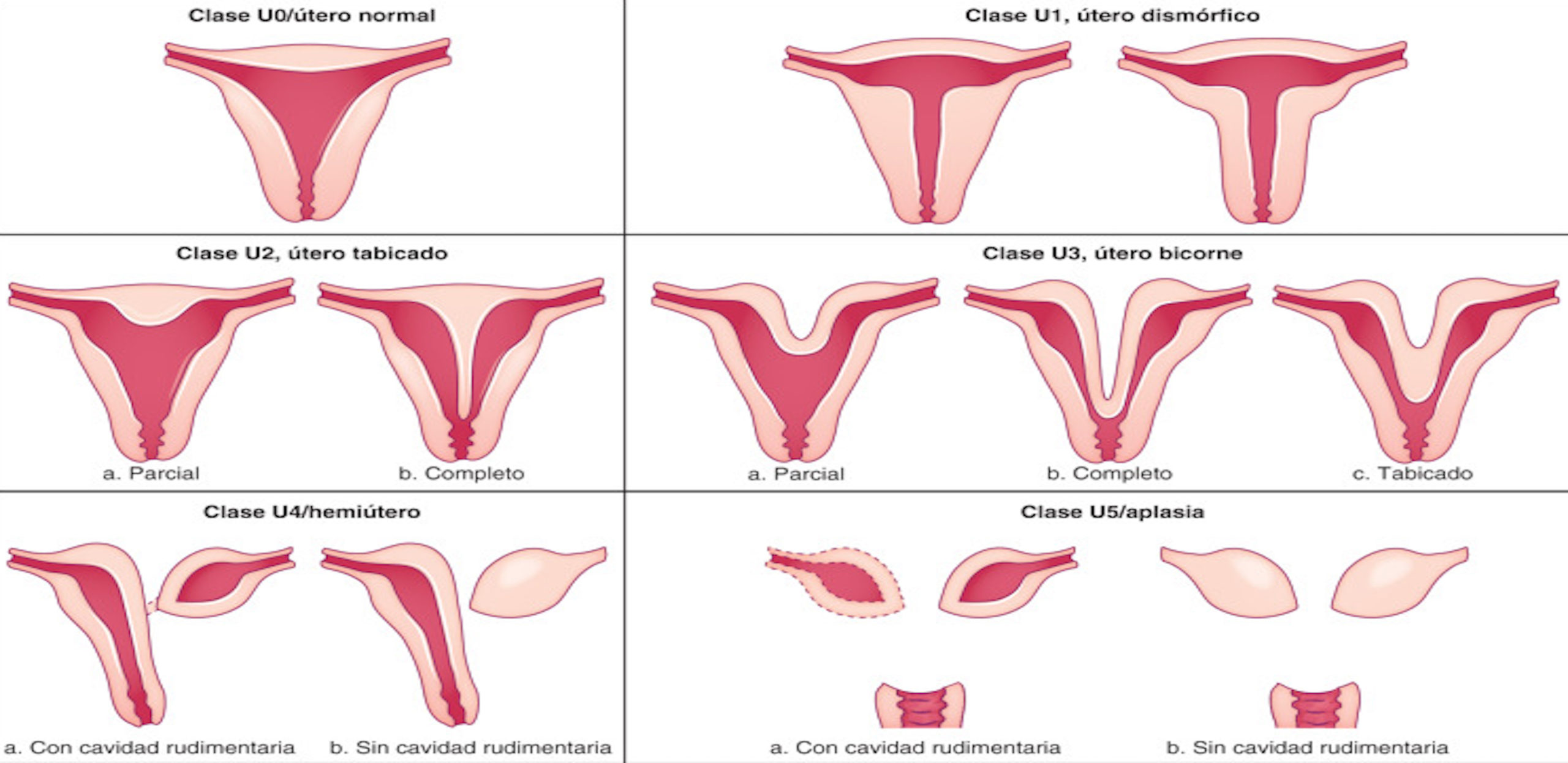 Malformaciones del aparato genital femenino